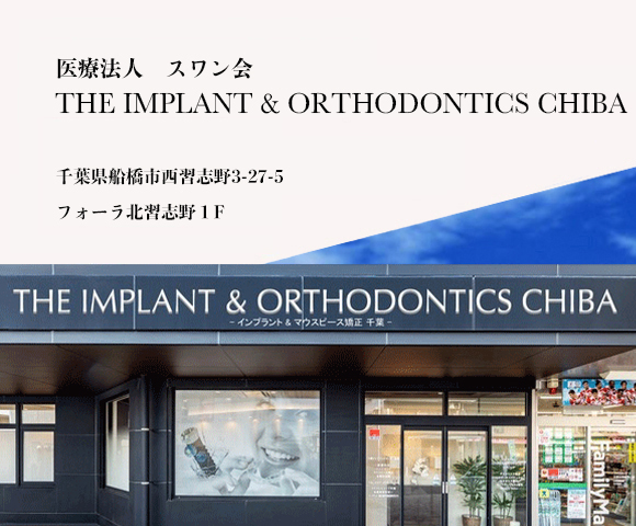 インプラント治療実績多数、千葉インプラント