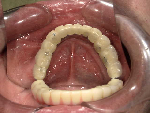 治療後3年経過時点
